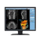 Eizo Radiforce MX217-SB