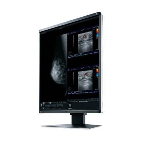 Eizo RadiForce RX560