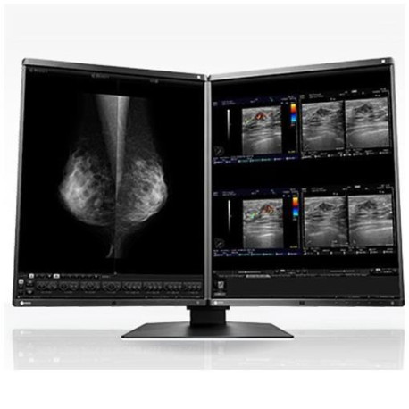 Eizo RadiForce RX560-MD