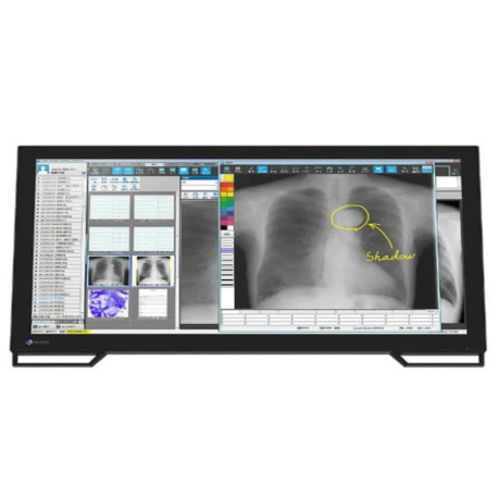 Eizo Radiforce MS236WT-A