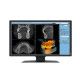Eizo Radiforce MX217-SB