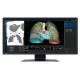Eizo RadiForce MX243W