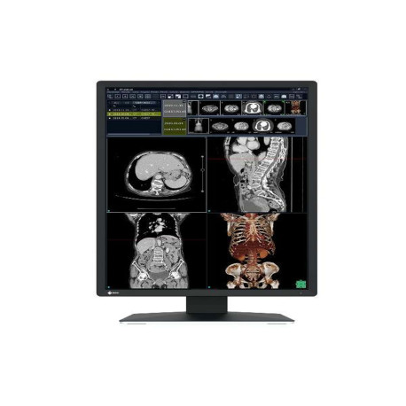 Eizo RadiForce RX270