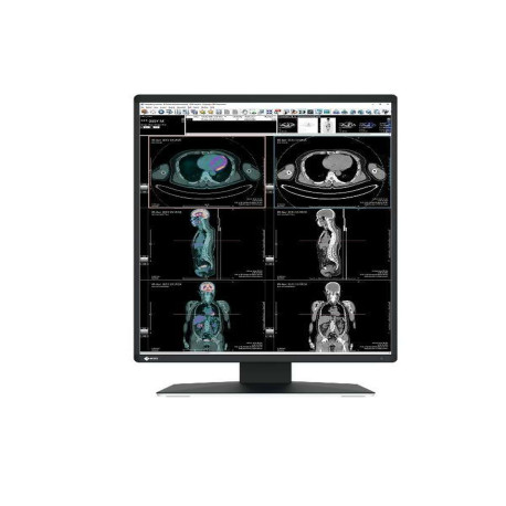 Eizo RadiForce RX370