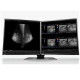 Eizo RadiForce RX560-MD