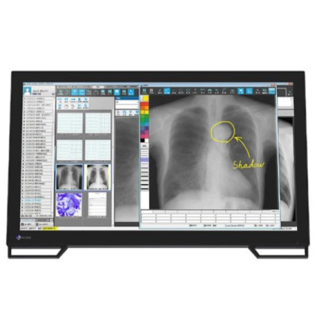Eizo Radiforce MS236WT-A