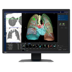 Eizo RadiForce MX243W