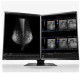 Eizo RadiForce RX560-MD
