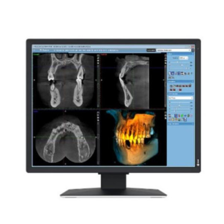 Eizo Radiforce MX217-SB