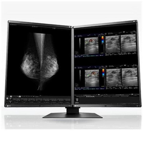 Eizo RadiForce RX560-MD